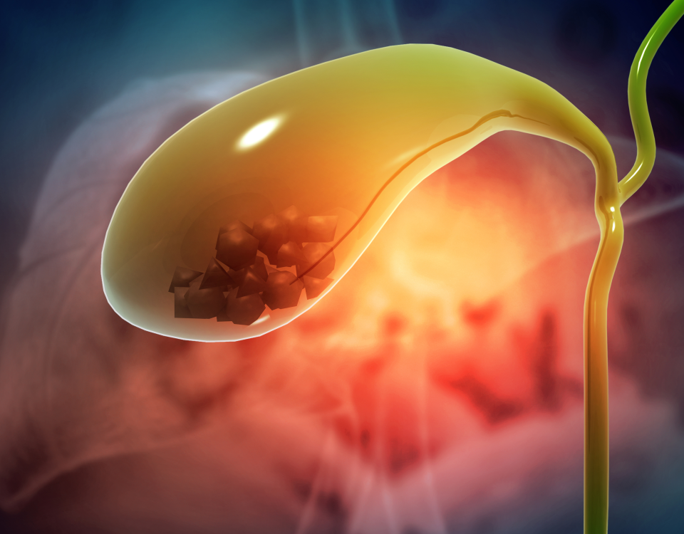 safra kesesi iltihabı