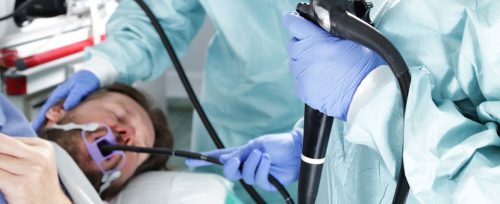 Ameliyat Sırasında Endoskopi