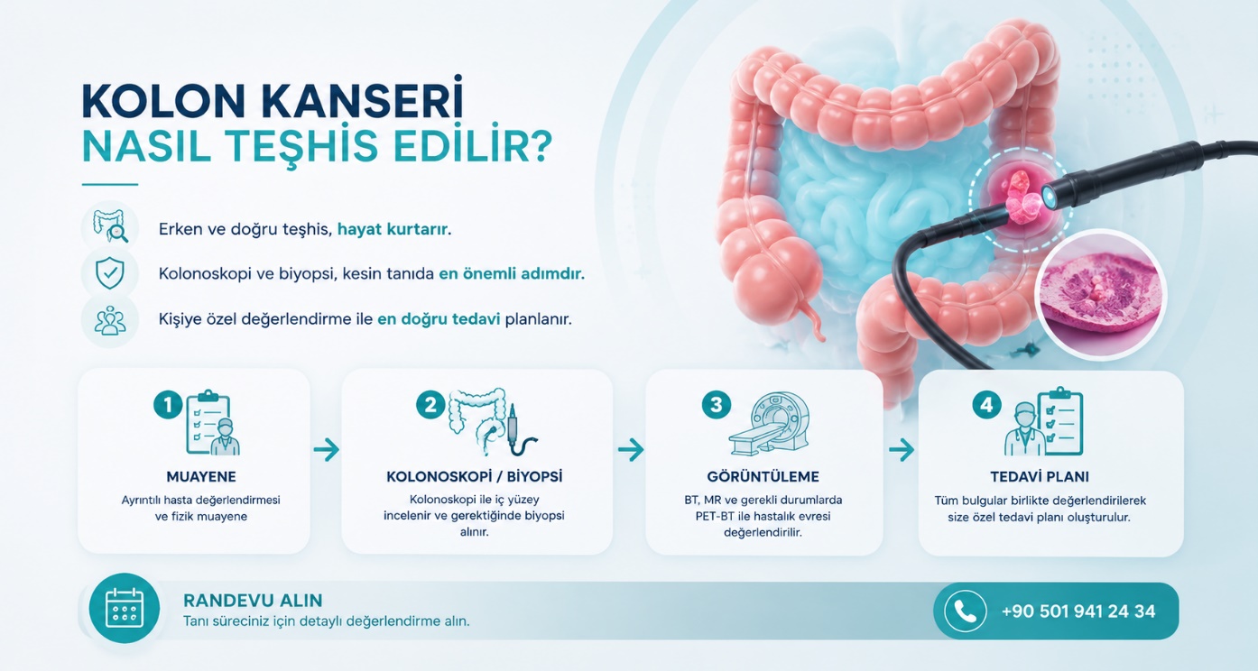 Kolon kanseri teşhis yöntemleri
