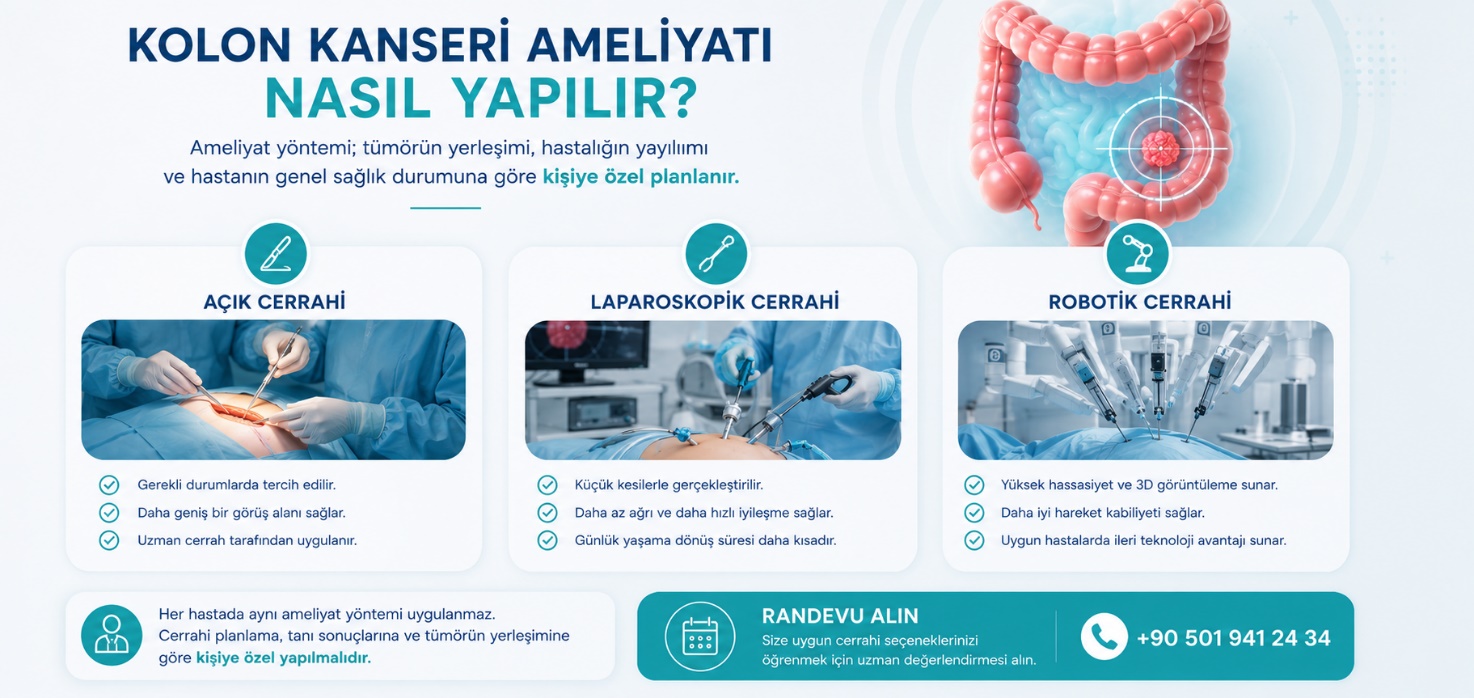 Kolon kanseri ameliyatı nasıl yapılır