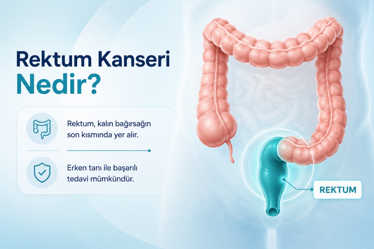 Rektum kanseri nedir