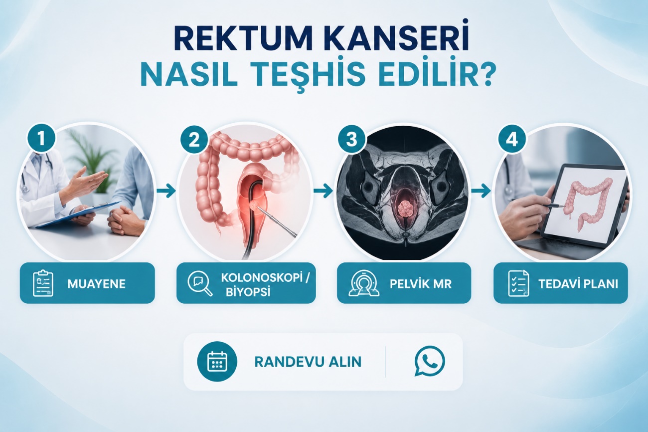 Rektum kanseri teşhis yöntemleri