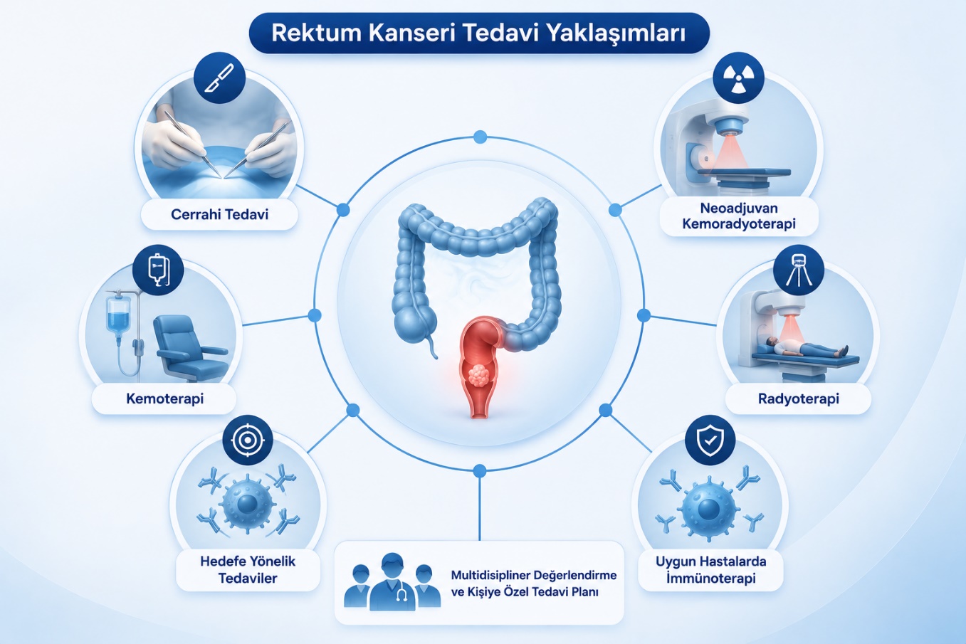 Rektum kanseri tedavi yöntemleri
